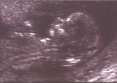 Baby Blade