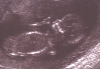 Baby Blade
