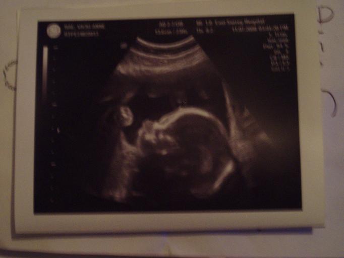Baby