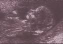 12 week scan pics