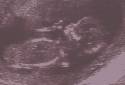 12 week scan pics